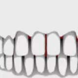 3D CAMO non prem teeth, bones