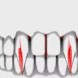 3D CAMO non prem teeth, bones